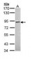 PRKCA / PKC-Alpha Antibody (aa1-250)